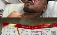 印航空难一名幸存者从残骸中走出，母公司为每名死者赔一千万卢比